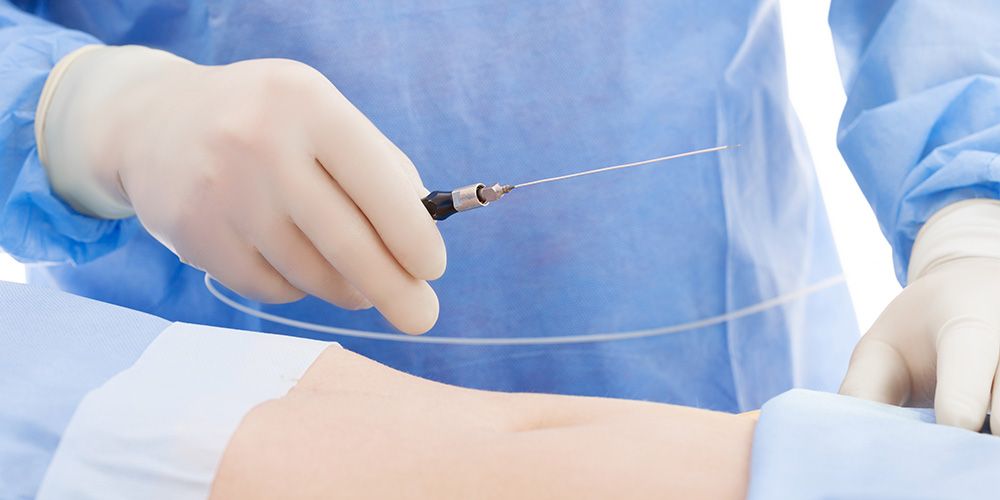 Подходит ли липосакция для коррекции фартука и в чем ее ограничения